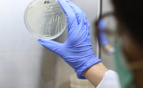 microbial-disc assay
